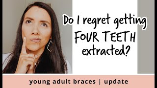 DO I REGRET GETTING 4 TEETH EXTRACTIONS FOR MY BRACES?