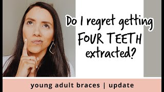 DO I REGRET GETTING 4 TEETH EXTRACTIONS FOR MY BRACES