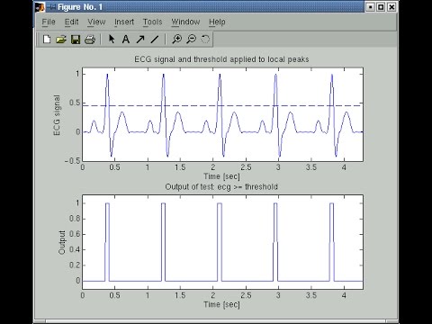Noise Removal ECG Signal Using Non Adaptive Filters and Adaptive Filter ...