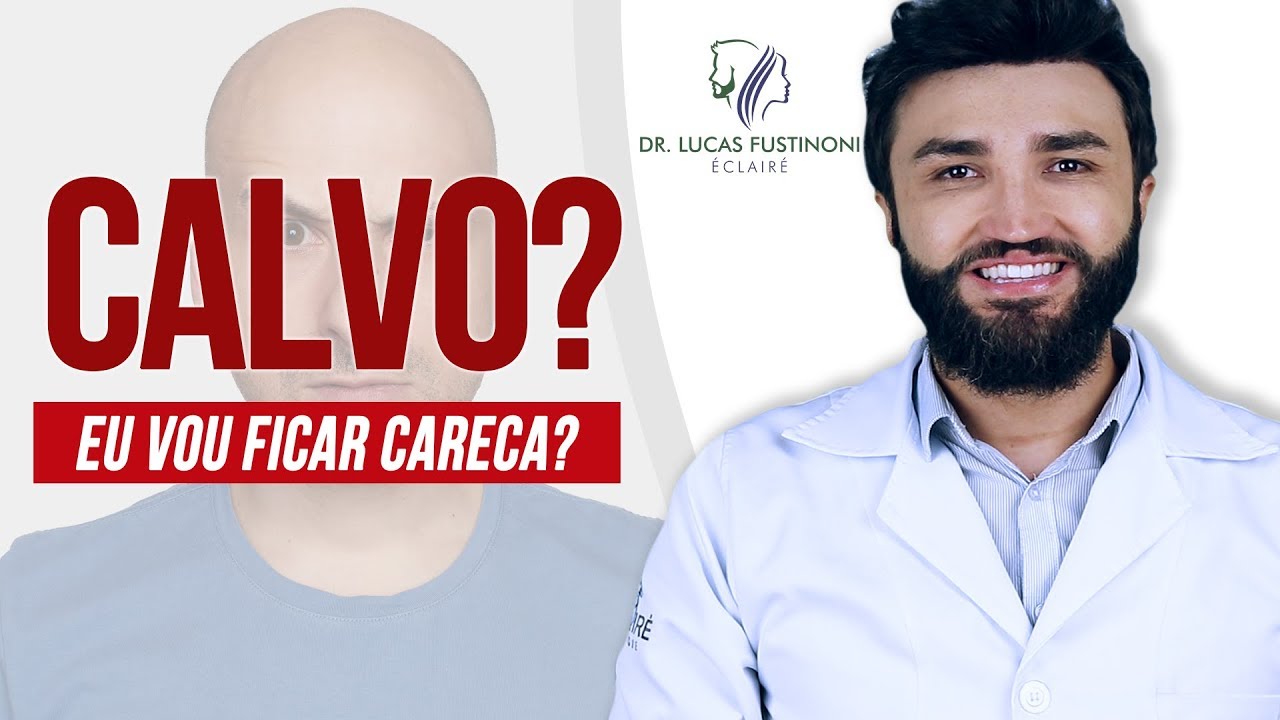 Será que eu vou ficar Calvo? Meu cabelo esta caindo | Calvície | Dr Lucas Fustinoni