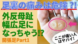 タコ/魚の目/足裏ジンジン！原因は底の薄い靴だと思ってない？本当は怖い足裏の痛みの原因とは？