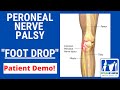 Peroneal Nerve Palsy with Foot Drop