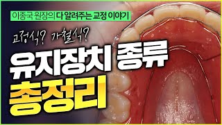 유지장치 종류  총정리해 드립니다.  가철식 & 고정식 유지장치(리테이너)