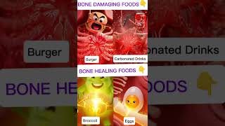 Bone Care Foods To Avoid Vs Foods To Eat