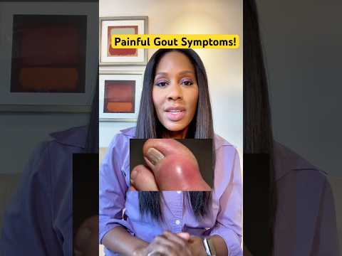 GOUT PAIN: What You Should Know! 🤕 #shorts