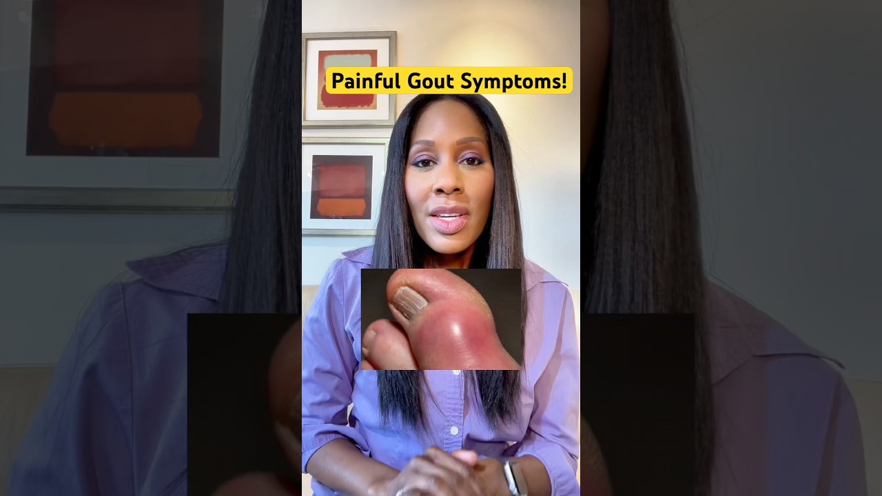 GOUT PAIN: What You Should Know! 🤕 #shorts