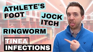 What Causes Ringworm Infection? Athletes Foot Cream. Treat Jock Itch Tinea Cruris