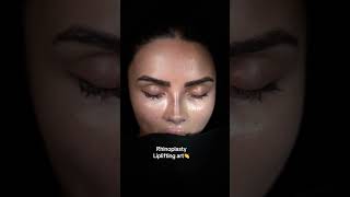 Rhinoplasty And Liplifting 👏👏👏