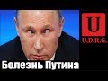 Болезнь Путина