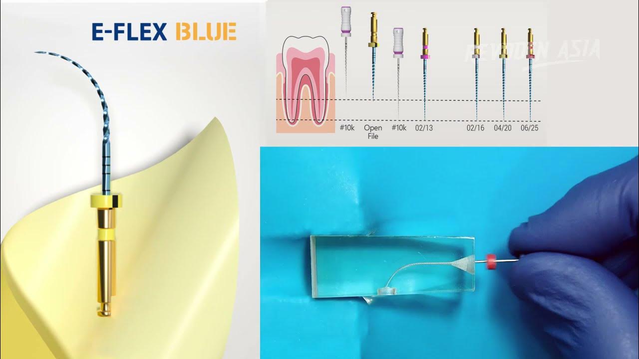 CARA PENGGUNAAN EFLEX BLUE ENDO FILE ROTARY EIGHTEETH REVODEN