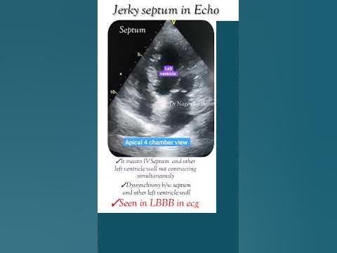 gabapentin jerky movements