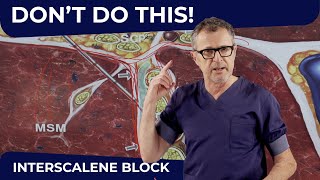 INTERSCALENE BLOCK: DON'T DO THIS!