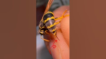 BUNUN SOKUŞU BİR BAŞKA😁