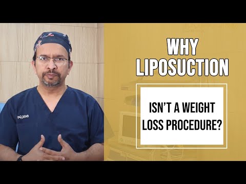 What to Know If You&rsquo;re Considering Liposuction | Is Liposuction a Weight Loss Procedure?