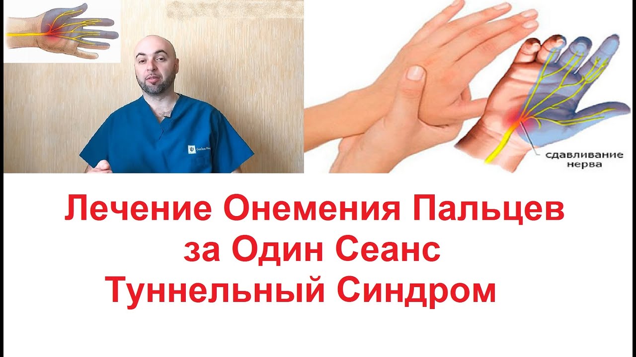 Немеют пальцы рук какой врач. Лекарство от онемения пальцев рук. Лекарства от онемении пальцев левой руки. Онемение пальцев рук причины.