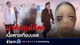 คลินิกผ่าตัดถุงใต้ตาพลาดหวิดบอด สาวแทบช็อกคนผ่าเป็นหมอทั่วไป | บรรจงชงข่าว | วันที่ 2 พฤษภาคม 2567