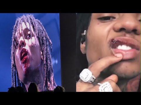 beautycon Swae Lee No Longer Suing A Fan For Throwing Phone & Busting His Lip On Stage📱👀