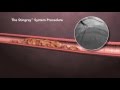 Cardiac Innovations & Structural Heart Center - CrossBoss Stingray Procedural Animation