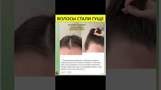 #уходзаволосами #волосопад #сибирскоездоровье #siberianwellness
