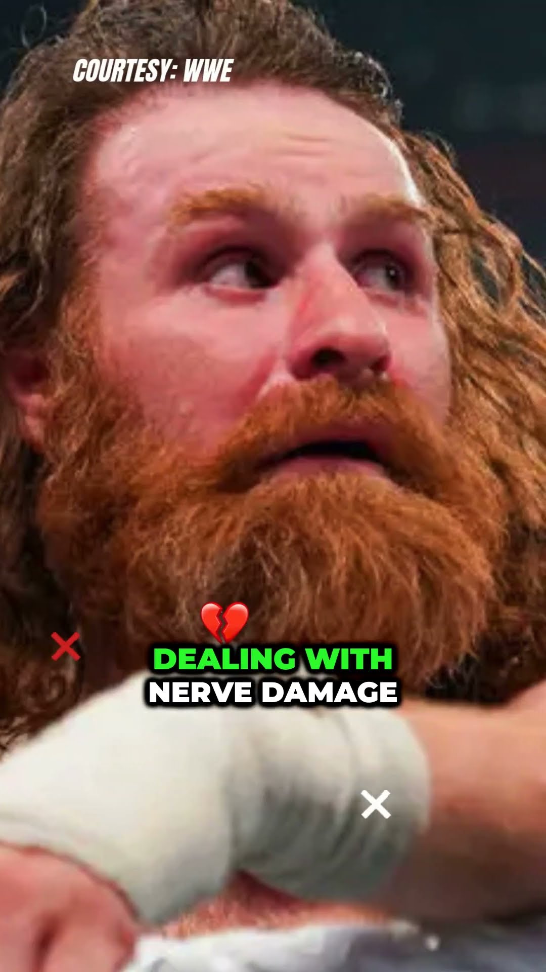Sami Zayn Opens Up on Neck Nerve Damage! This Betrayal Cuts Deep! #SamiZayn #KevinOwens #WWE #shorts