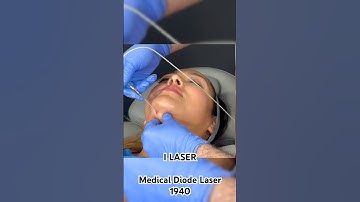 💡 Meet the I-LASER System