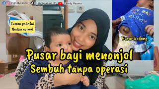 Cara mengatasi pusar menonjol / bodong pada bayi #bodong #pusatbodonh #herniaumbilikal