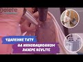 Инновационный лазер RevLite. 3-я процедура удаления тату