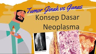 Konsep Dasar Patologi Anatomi : Tumor Neoplasma Jinak vs Ganas screenshot 1