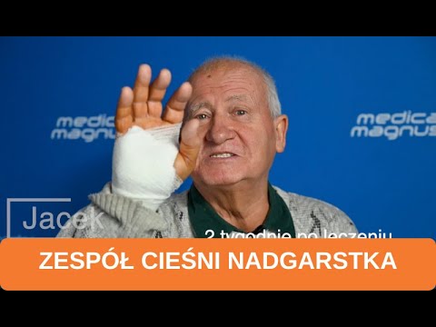 Wideo: 4 sposoby leczenia cieśni nadgarstka bez operacji