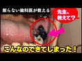 【閲覧注意】口腔内の不気味なものが突如出て来た！？これ大丈夫ですか？