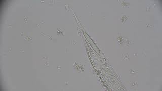 Beneficial Nematode bubbles