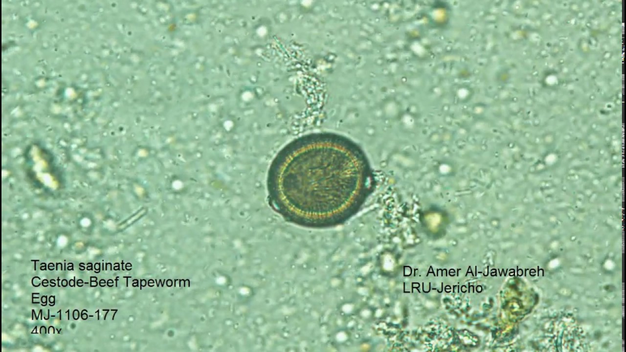Taenia Saginata Egg YouTube Taenia Saginata Egg YouTube