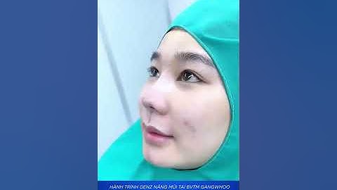 CÔ NÀNG 2K QUYẾT ĐỊNH NÂNG MŨI TẠI BÁC SĨ PHÙNG MẠNH CƯỜNG ĐỂ XINH ĐẸP VÀ TỰ TIN HƠN