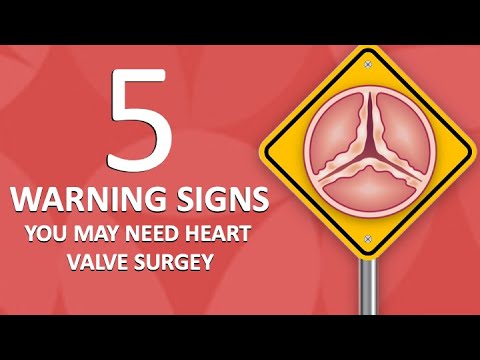 Patient Webinar 5 Warning Signs You May Need Heart Valve Surgery