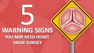 Patient Webinar: 5 Warning Signs You May Need Heart Valve Surgery