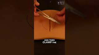 Learn how to place a suture (stitch) in under one minute
