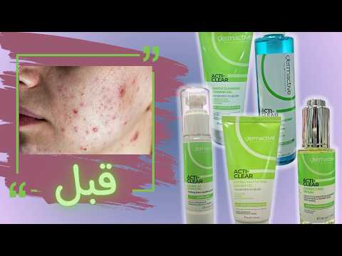 ٥ حلول للبشرة الدهنية   