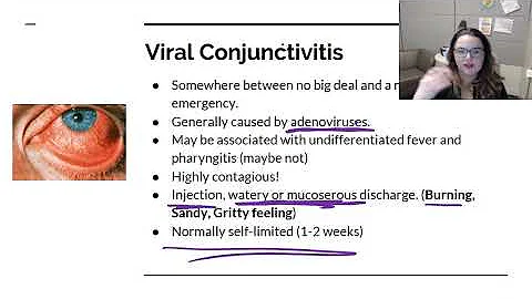 Bacterial and Viral Conjunctivitis - DayDayNews