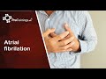 Atrial fibrilation