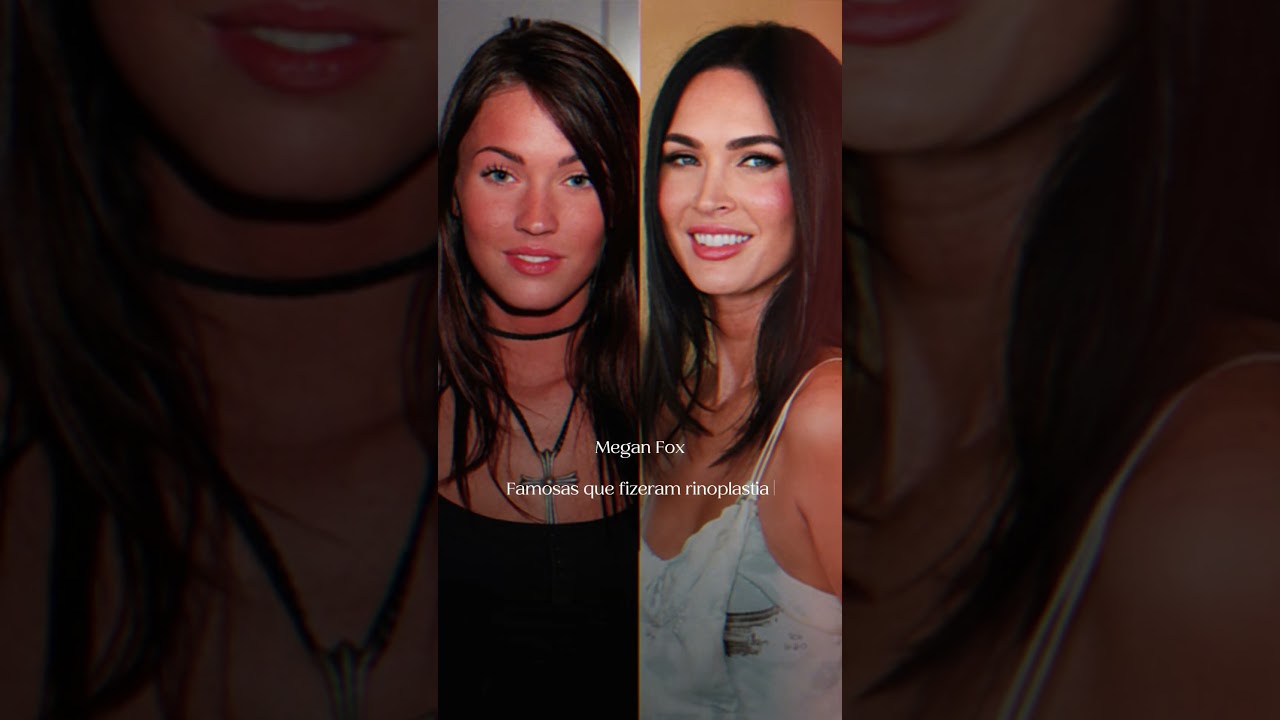 Famosas que fizeram rinoplastia jovem e envelheceram com elegância