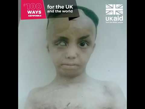 100 Ways Aid Works - #98
