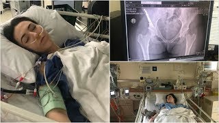 ♡ My Journey with Hip Dysplasia &amp; Surgery! | Amy Lee Fisher ♡