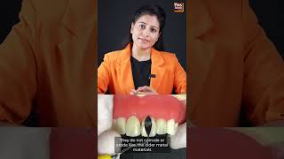 What are Dental Composite? | When to Get the Composite Done? | FMS Dental