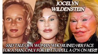 Jocelyn Wildenstein! - She claimed she ruined herself trying to please her husband...- OHS