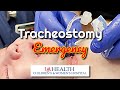 Airway emergency a rapidly closing tracheostomy site