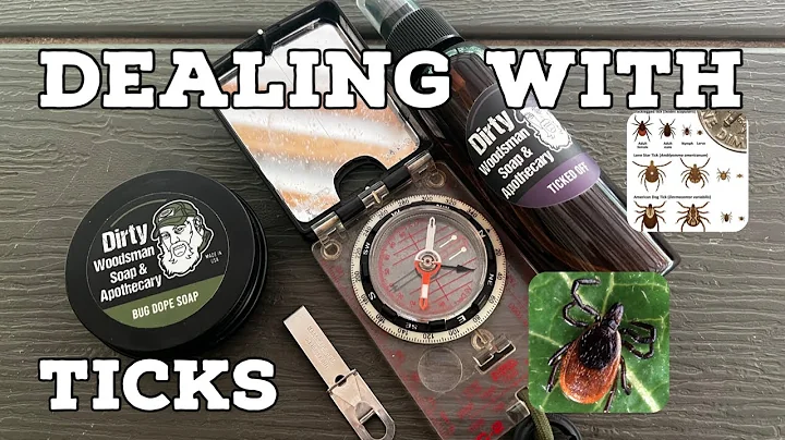 TICKS  How to Deal with them!