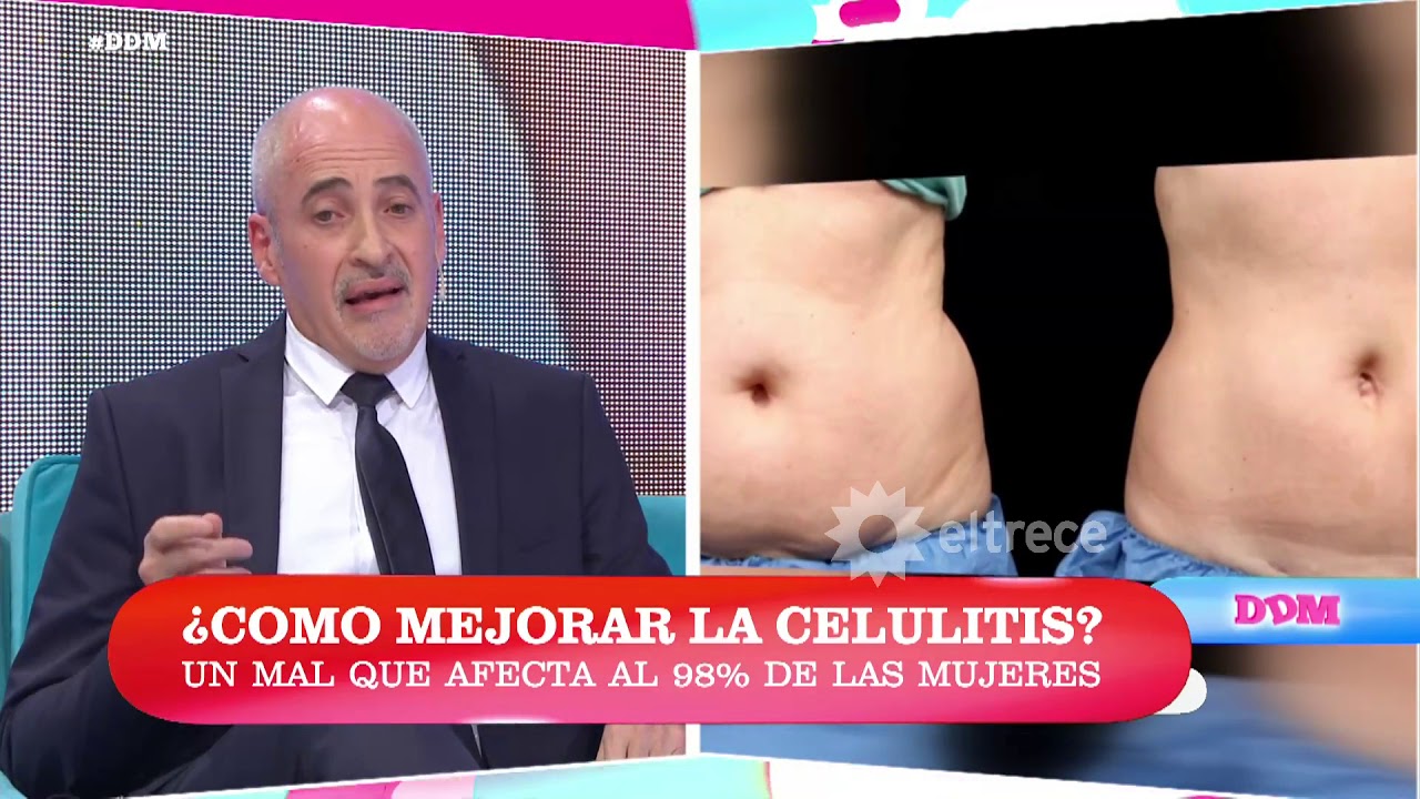 celulitis medico especialista celulitis medico especialista