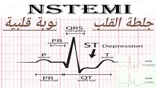 جلطة القلب.الأزمة القلبية.NON ST SEGMENT ELEVATION.NSTEMI  NON ST ELEVATION MYOCARDIAL INFARCTION