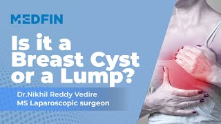 Breast Cyst: What you need to know!