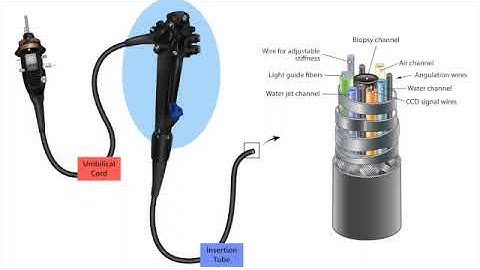 Podcast-GI Endoscopy Technology Primer: 1. Check-in to Procedure - 3.Endoscope Design